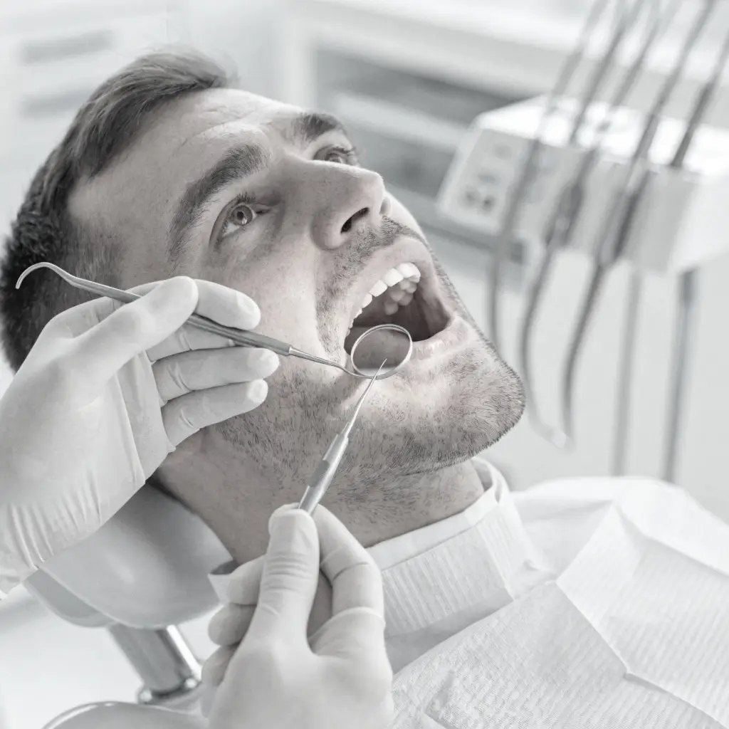 Tratamiento de Periodoncia en DiBian Odontología en Belgrano, CABA