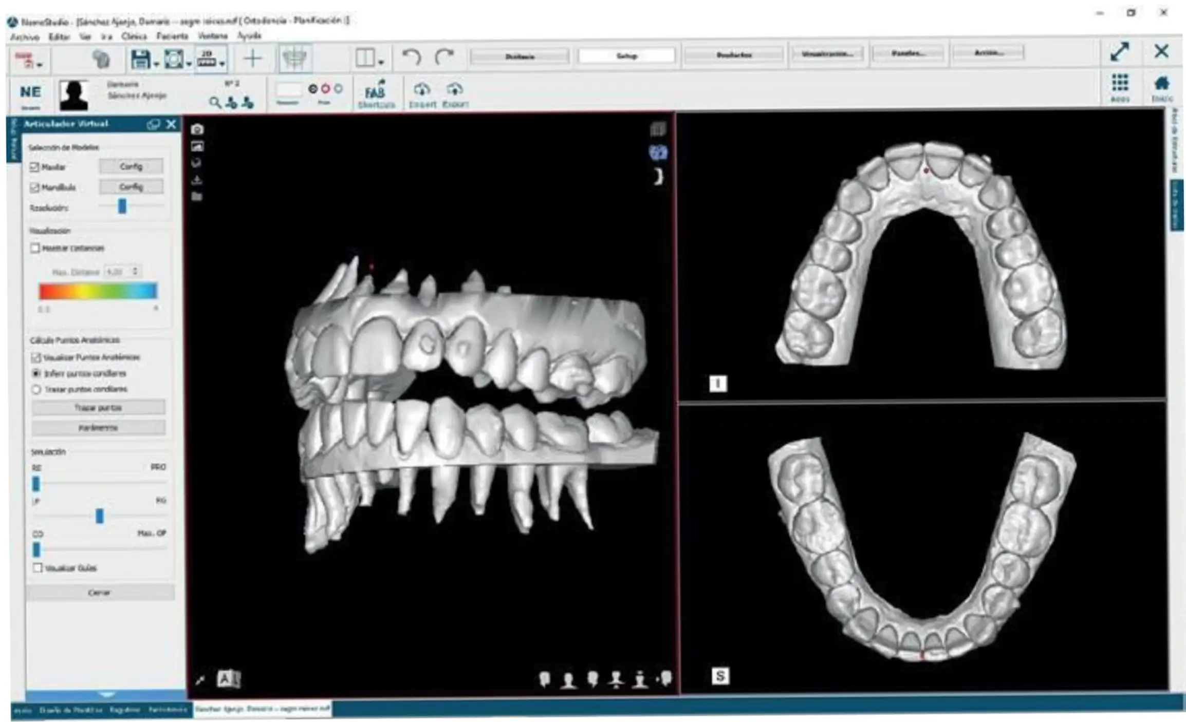 Flujo Digital en DiBian Odontología en Belgrano, CABA